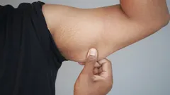 Så blir du av med slappa armar med hemmaträning: enkla tips du kan börja använda redan idag